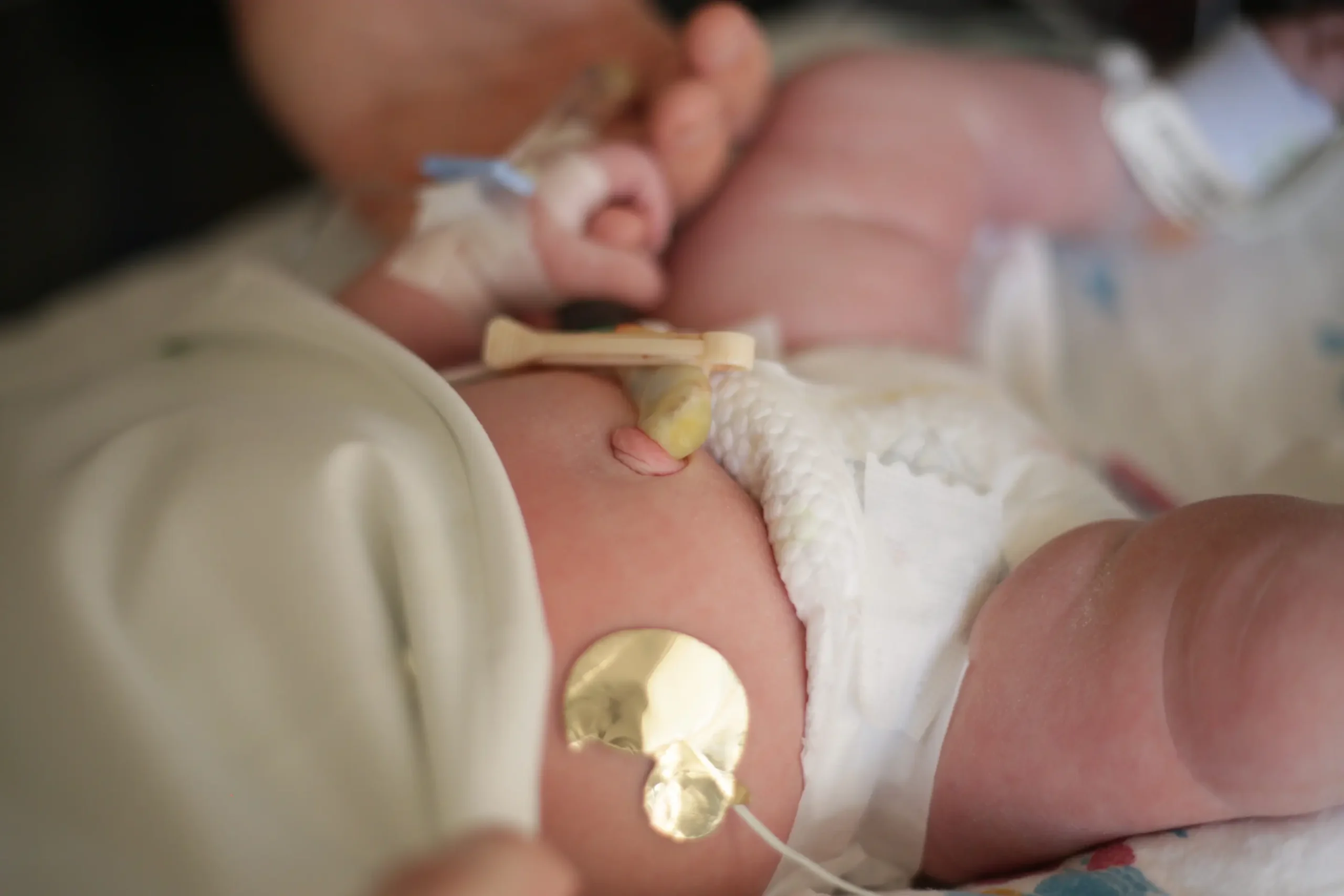 Combien de temps reste un bébé prématuré à l'hôpital ? may app santé